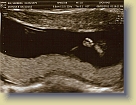 Week12-Ultrasound-01Aug2011 (4) * 3079 x 2323 * (3.53MB)